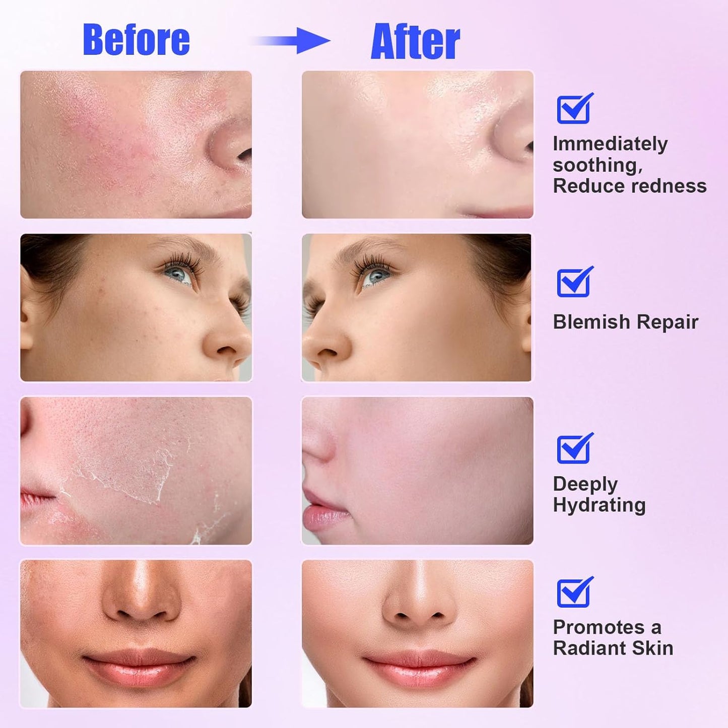 Madecassoside Sheet Mask Blemish Repair, Collagen Face Mask- Hyaluronic Acid, Niacinamide, Panthenol, Centella Facial Masks for Sooth, Hydration, Firming, Korean Skin Care, Stocking Stuffers